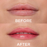 DEWY MOISTURIZING LIP BALM BEFORE AFTER