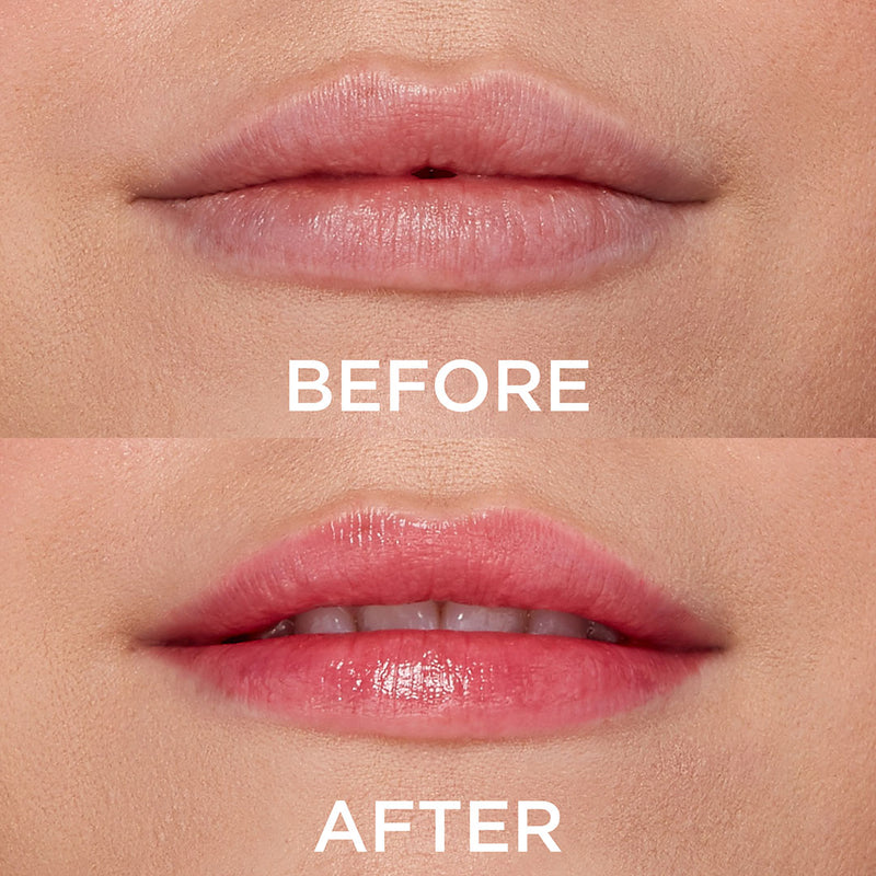 DEWY MOISTURIZING LIP BALM BEFORE AFTER