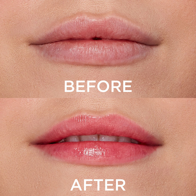DEWY MOISTURIZING LIP BALM BEFORE AFTER